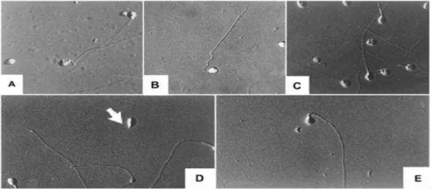 Figura  3:  Microscopia  apresentando  os  defeitos  morfológicos  mais  comuns  nos  espermatozóides  de  Tilápia (O