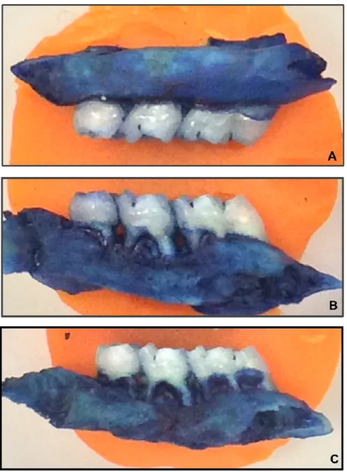 Figura 8 - Aspecto macroscópico do periodonto de ratos normais (a) ou submetidos  à reabsorção óssea alveolar induzida por ligadura – não-tratado (b) ou 5-FU 37,5 (c),  75 (d) e 150 (e)