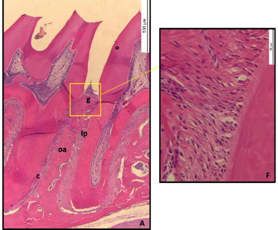 Figura  10  -  Fotomicrografias  evidenciando  o  efeito  do  5-FU  sobre  as  estruturas  periodontais de ratos submetidos à reabsorção óssea induzida por ligadura