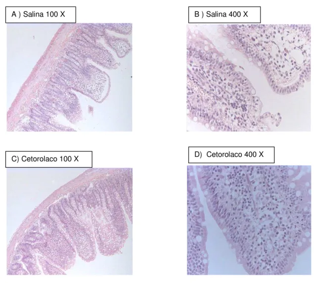 Figura  7.  A)  Fotomicrografia  (100x)  do  íleo  de  ratos  controle  B)  )  Fotomicrografia (400x)  do  íleo  de  ratos  controle  C)  Fotomicrografia  (100x)  do  íleo  de  ratos  em  H&amp;E  E  após  tratamento  com  cetorolaco  D)  Fotomicrografia  