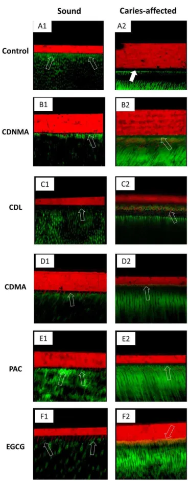 Figure  5.  Confocal  micrographs  showing  the  main  features  of  fluorescein  micropermeability