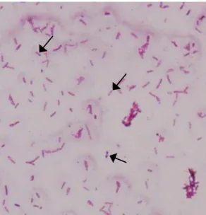 Figura  02.  Biofilme de  B.  pseudomallei corado pelo Vermelho Congo, apresentando bacilos Gram-negativos