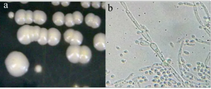 Figura 2. Aspectos macromorfológicos (a) e micromorfológico (b) do Complexo Candida parapsilosis.