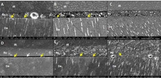 Figure 2 - Representative SEM images of the resin–dentin interfaces bonded  with Relyx U200 (RU)  and  MaxCem  Elite  (ME)  in  the  immediate  groups  without  (control;  A  and  D)  or  with  dentin  deproteinization (NaOCl: B and E; Etching + NaOCl: C a