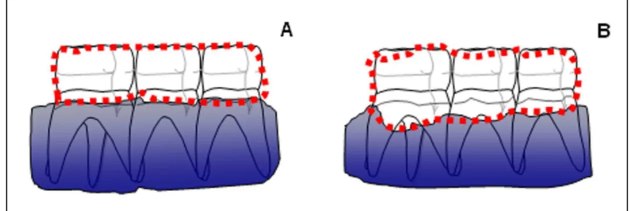 Fig. 1. Representation of the demarked area for alveolar bone resorption measurement. Area of  contralateral  hemimaxilla  (A)  and  its  hemimaxilla  with  periodontitis  (B),  whose  difference  was  considered as value of alveolar bone resorption (mm 2 