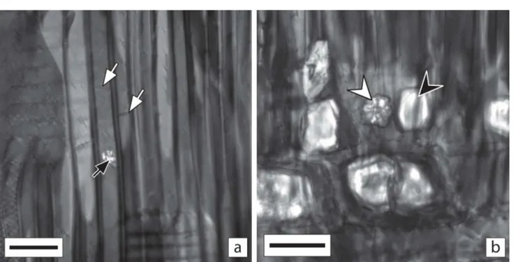 Figura 6. Secções radiais. a. Aglomerado de cristais no lume de uma fibra (seta preta); fibras septadas (setas brancas)