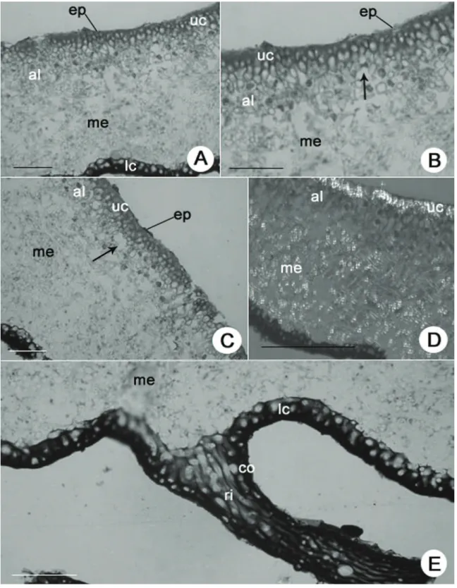 Figura 1. Anatomia do talo de Parmotrema consors. A. Secção transversal, mostrando epicórtex (ep), córtex superior (uc), camada de  algas (al), medula (me) e córtex inferior (lc)