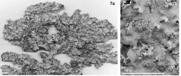 Figura 7. Parmotrema subisidiosum 7a. Hábito. 7b. Detalhe (Marcelli 3904). Barras de escala = 1 cm.