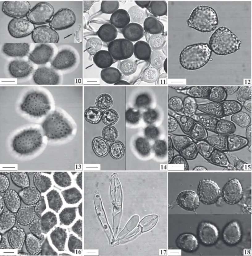 Figura 10. Phakopsora colubrina (IBI18369). 10. Acima, urediniósporos em vista mediana e à direita (seta), aspecto da paráfise do soro uredinial