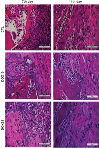Figure 1 Representative photomicrographs of alveolar tissues after tooth extraction. On the 7th day, the CTL group exhibited no healing and signi ﬁ cant in ﬂ ammatory in ﬁ ltrate and ﬁ broblastic proliferation