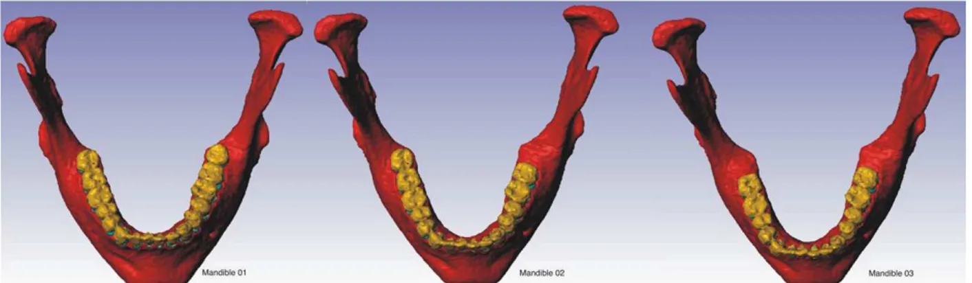 Fig. 1. The three structures developed in the study. Mandible 01 with both third molars; mandible 02 without the left third molar; mandible 03 without both third molars.