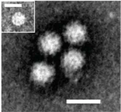 Figura 1  –  Microscopia eletrônica de partículas de Norovírus oriundas de sobrenadante de enterócitos  humanos infectados