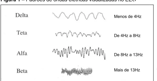 Figura 1 – Padrões de ondas elétricas visualizadas no EEG 