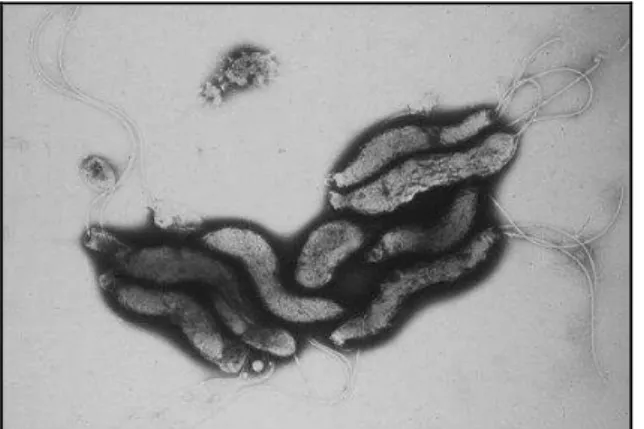 Figura 1: Micrografia de transmissão eletrônica de  Campylobacter jejuni .  