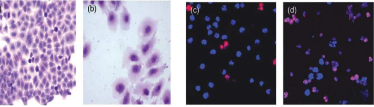 Figura 5: Efeito  in vitro  da incubação com CDT recombinante reconstituída (CjejCDT)