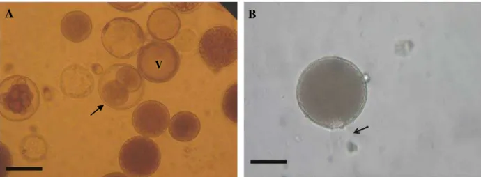 Figura  3  –  (A) Esporulação in vitro de  P. beihaiensis  em água do mar filtrada estéril
