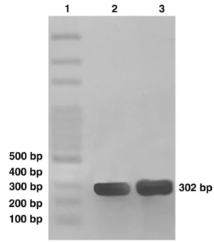 Fig. 1. Agarose gel electrophoresis of PCR products produced from B. pseudomallei. Lane 1, 100-bp ladder marker; 2, bronchoalveolar lavage sample; 3, control culture (strain number CEMM BP 01)