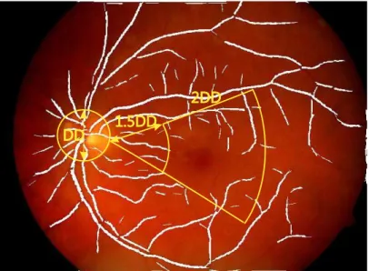 Figura 14 Ű Exemplo da detecção da ROI proposta por Sagar et al. (2007).