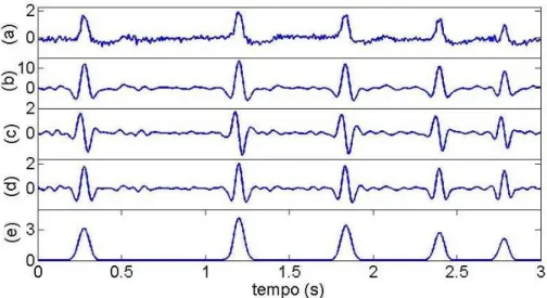 Figura 2.8: aplica¸c˜ao sequencial sobre (a) um trecho de sinal ECG da (b) transformada Wavelet, (c) da fun¸c˜ ao primeira-derivada, (d) da transformada de Hilbert e (e) do quadrado do sinal anal´ıtico correspondente.