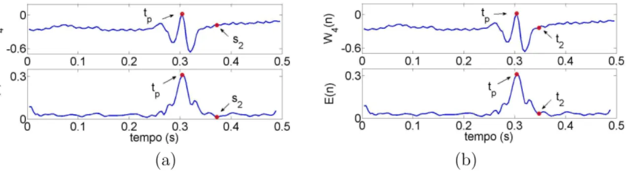Figura 4.7: janela de busca para a segmenta¸c˜ao de QRS e sinal envelope: (a) identifica¸c˜ao do ponto final do envelope t = s 2 para WL = W L 0 = 150 ms, e (b) para W L = 68 ms.