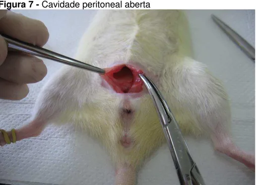 Figura 7 - Cavidade peritoneal aberta 