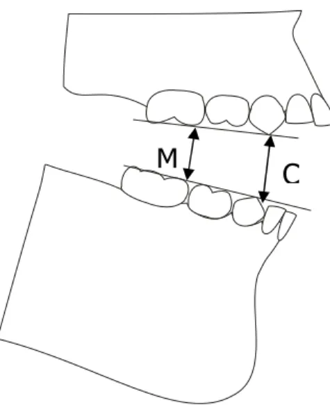 Figura 1 – Medidas das distâncias entre cúspides dos caninos superiores e inferiores (CC)  e  as  cúspides  mesio-vestibulares  dos  segundos  molares  superiores  e  inferiores  decíduos  (MM) do lado direito, e medida do ângulo formado entre os planos oc