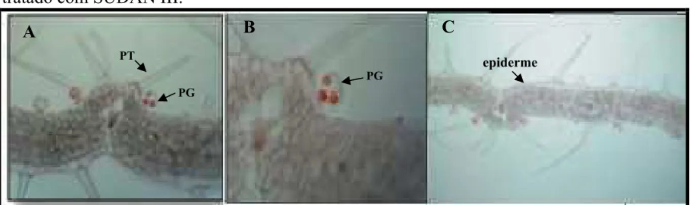 Figura  9  –  Fotomicrografia  da  droga  pulverizada  corada  com  SUDAN III.  
