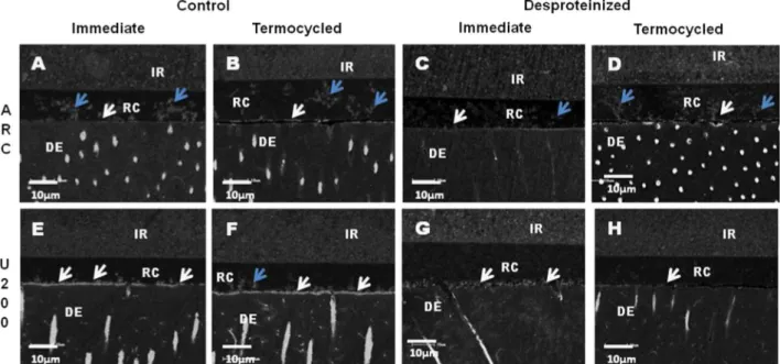 Fig. 1. -Representative backscattering SEM images of the resin–dentin interfaces bonded with RelyxARC (ARC) and Relyx U200 (U200) in the initial period (A, C, E and G) or after thermocycling (B, D, F and H) without (control; A, B, E and F) or with dentin d