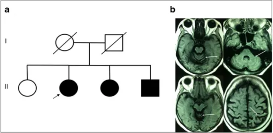 Fig. 1 Pedigree of the present DRPLA case (a). Brain MRI shows mild cerebellar and global cerebral cortex atrophy (b)