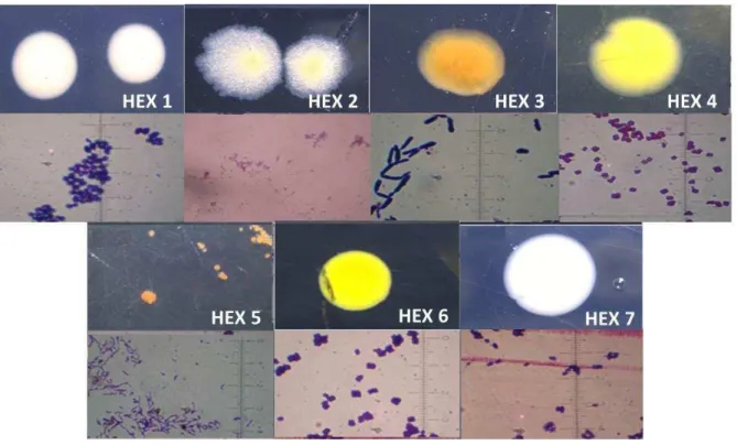 Figura  6:  Aspecto  das  colônias  e  células  das  linhagens  de  bactérias  do  consórcio  HEX,  cultivadas em meio ATGE com 2% (m/v) de NaCl