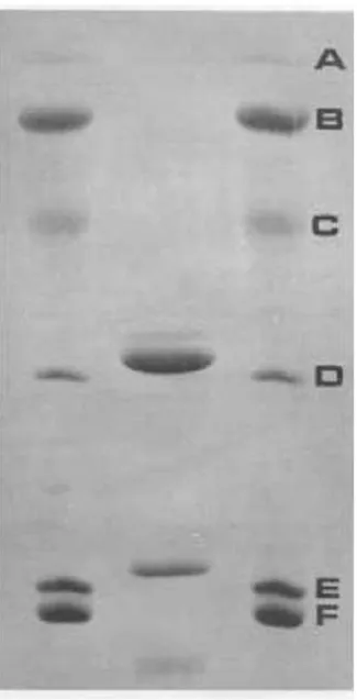 Figura  3  –   Gel  de  eletroforese  em  presença  de  2-mercaptoetanol  da  lectina  purificada  de  Dioclea  virgata   (DvirL)  -  Coluna  1  e  3  marcador  molecular(A,  Fosforilase  B,  94400  Da; 