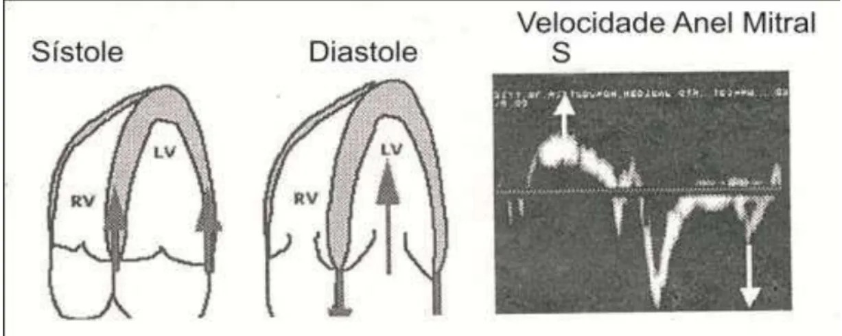 Figura 8-   Desenho  esquemático  demonstrando  o  movimento  do  anel  mitral  durante  a 