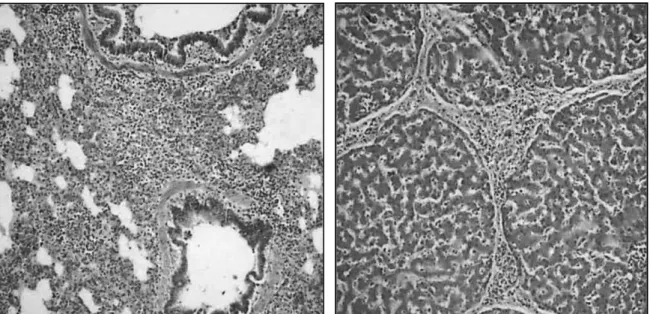 Figura 4  –  Hepatite portal linfohistiocitária  –  10X  –  HE Figura 3 – Broncopneumonia aguda – 10X – HE 