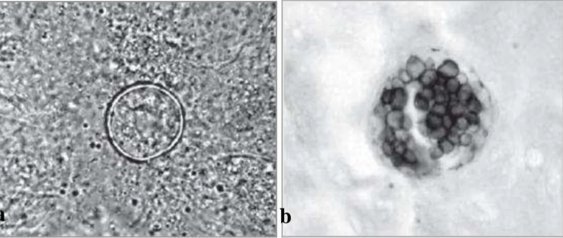 Figura  5:  Diagnóstico  laboratorial  de  Coccidioides   spp.  a.  Exame  direto  de  escarro  em  preparação  com  KOH  10%,  mostrando  uma  esférula  repleta  de  endósporos