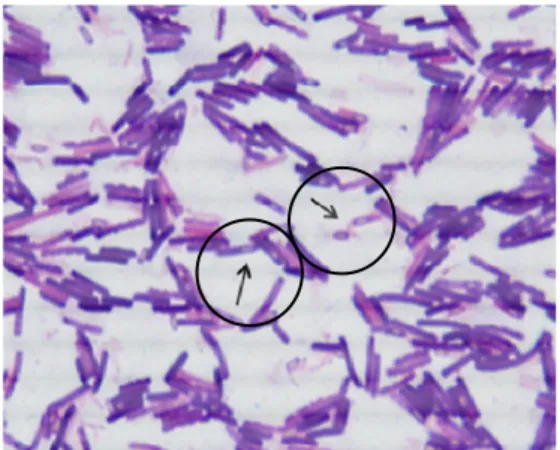 Figura  1:  Coloração  de  Gram  de  cepa  de  Clostridium  difficile  isolada  a  partir  de  fezes  de  pacientes  internados  no  Hospital  Haroldo  Juaçaba  para  a  visualização  dos  esporos  subterminais (Aumento 1000x)