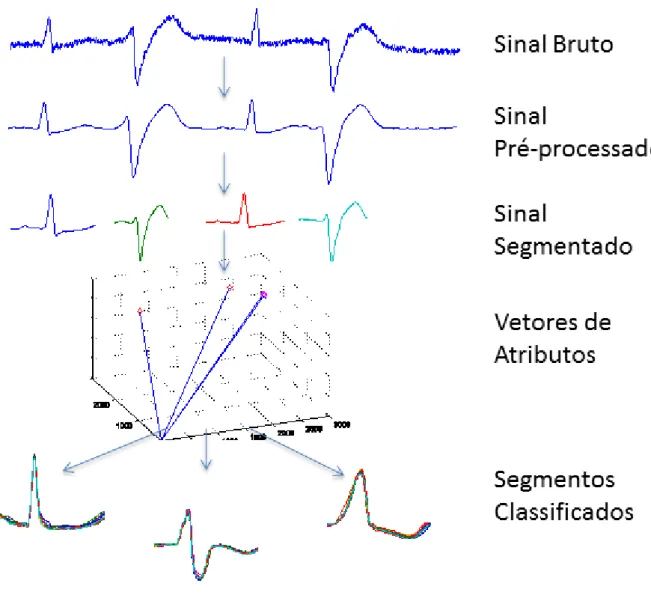 Figura 6 – Etapas da classificação de sinais em eletrocardiograma.