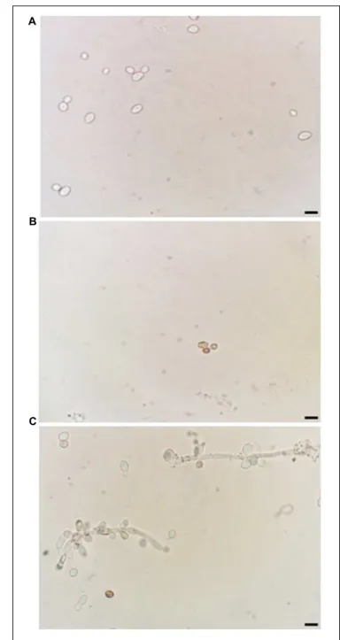 FIGURE 2 | Induction of ROS generation in C. albicans. Light micrography of cells previously treated with 0.15 M NaCl (A), 11.11 µM nystatin (B), or 18.90 µM Mo-CBP 2 for 24 h at 37 ◦ C (C), followed by incubation with DAB.