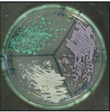 Figura 2 – CHROM ágar:  Candida  parapsilosis colônias brancas e colônias lilás 