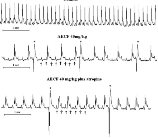 Fig. 3. Original traces showing a typical record of the electrocardiogram in control anesthetized rats, after administration of aqueous extract of Caesalpinia ferrea (AECF) (40 mg/kg; i.v.) and after AECF (40 mg/kg; i.v.) plus atropine (2 mg/kg, i.v.)
