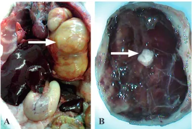 Figura 24 – A - Volumoso abscesso em cavidade torácica ocupando todo o  hemitórax esquerdo (seta)