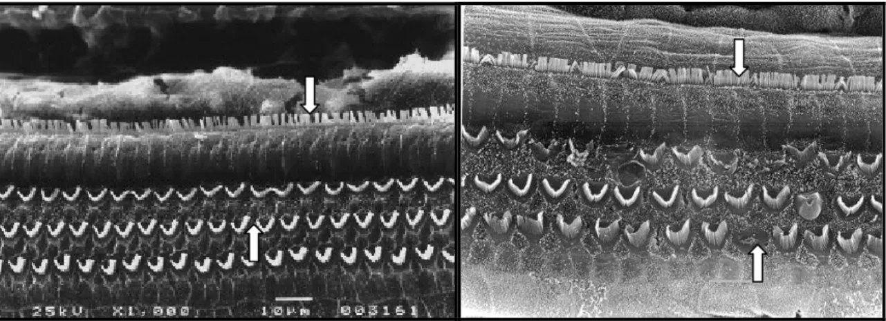 FIGURA 6 – Fotomicrografia de microscopia eletrônica de varredura do giro basal da cóclea de cobaia albina