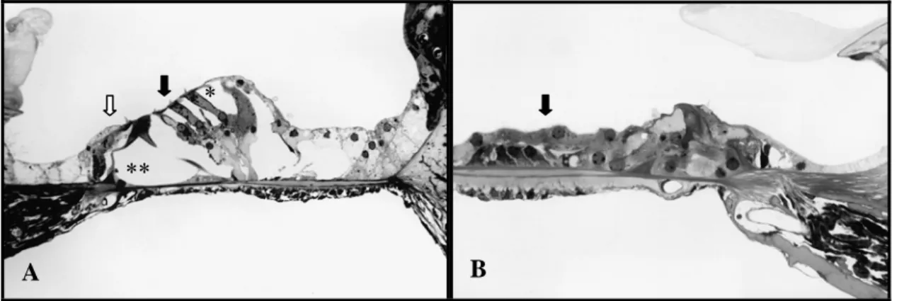 FIGURA 7 – Fotomicrografia do órgão espiral de Corti de cobaia albina. A. Notam-se as células ciliadas  externas (seta preta) e célula ciliada interna (seta vazia) bem preservadas e os espaços de Nuel (*) e túnel espiral  de Corti (**) individualizados