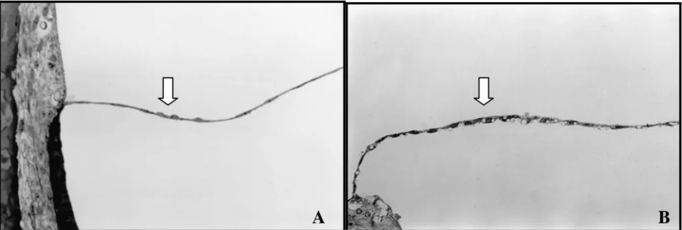 FIGURA 10 – Fotomicrografia da membrana vestibular de cobaia albina. A. Membrana vestibular normal (seta)
