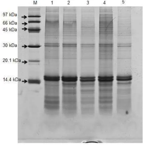 Figura  1:  PAGE-SDS  12  %  de  proteínas  de  membrana  de  hemácias  de  pacientes  falcêmicos e grupo controle