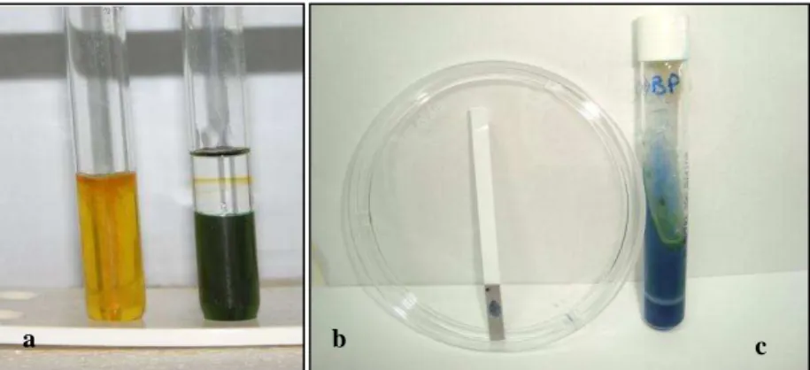Figura  2.  Testes  bioquímicos  utilizados  na  triagem  de  B.  pseudomallei.  (a)  teste  de  fermentação/oxidação  de  glicose  (Hugh-Leifson)  com  padrão  oxidativo  evidenciado  pelo  crescimento  em  amarelo  no  tubo  não  selado  e  manifestação 