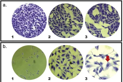 Fig. 2. Morphological alterations in SK-Mel cells treated with biﬂorin for 24 h performed by crystal violet staining