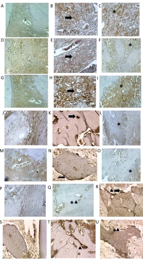 Figure 4. Photomicrographs of periodontal tissue of PD rats treated with AZT, showing immunoreactivity to MMP-2, MMP-9, COX- COX-2, RANK, RANK-L, OPG, and cathapsyn
