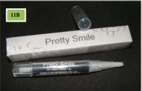 FIGURA 11 B  -  Clareador Pretty Smile (DMC) na forma de caneta pincel. Fonte: acervo  pessoal 
