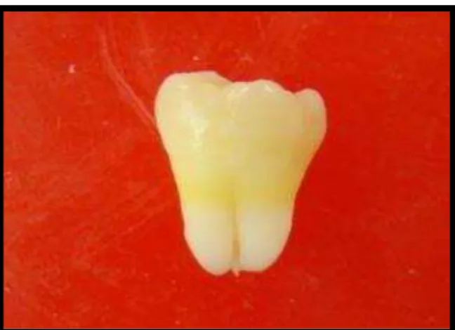 FIGURA 12 - Terceiro molar extraído e tratado, pronto para o início da pesquisa 