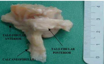 FIGURA 3b  – Bloco ósseo com identificação dos três ligamentos 